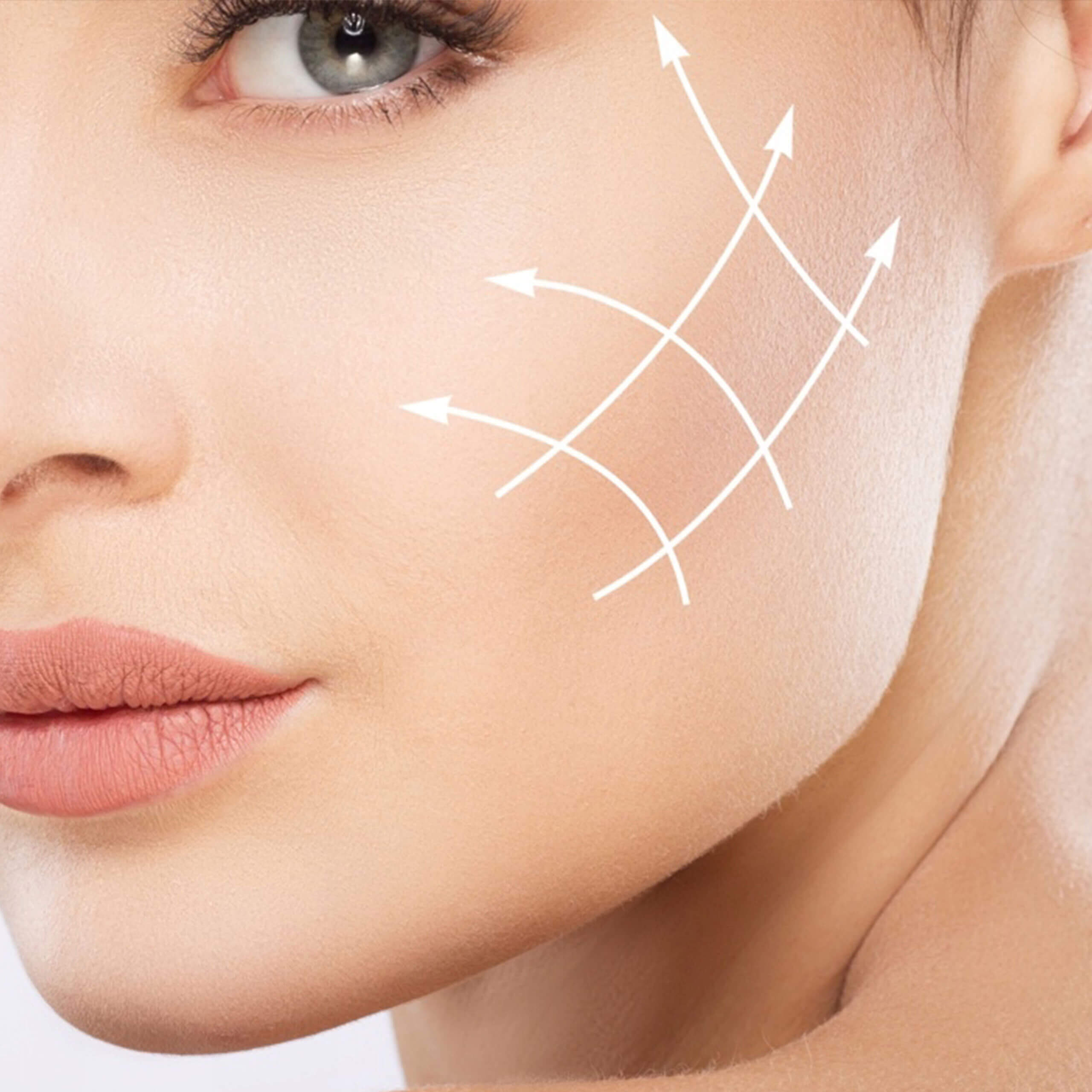 Dermal Fillers