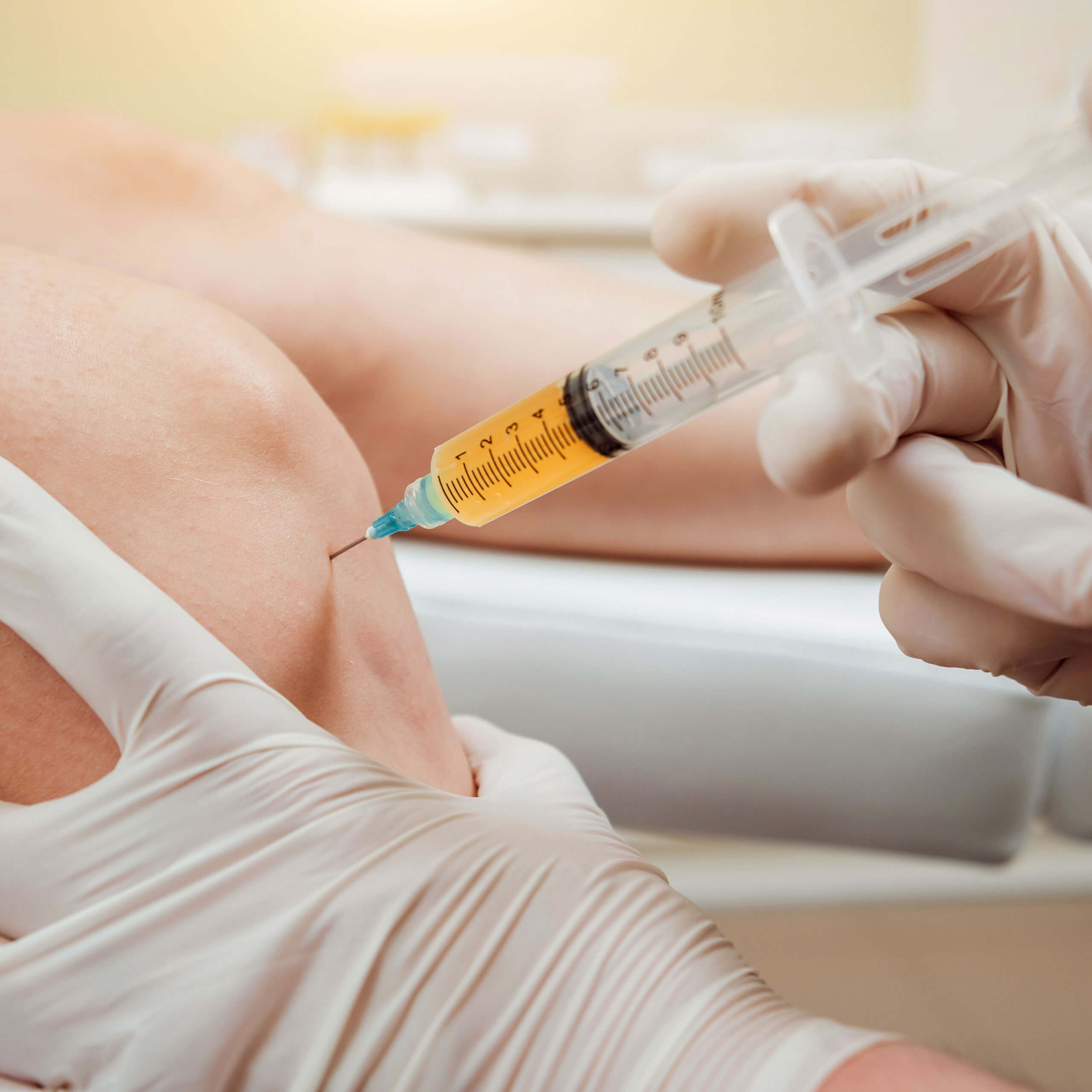 Platelet Rich Plasma (PRP)