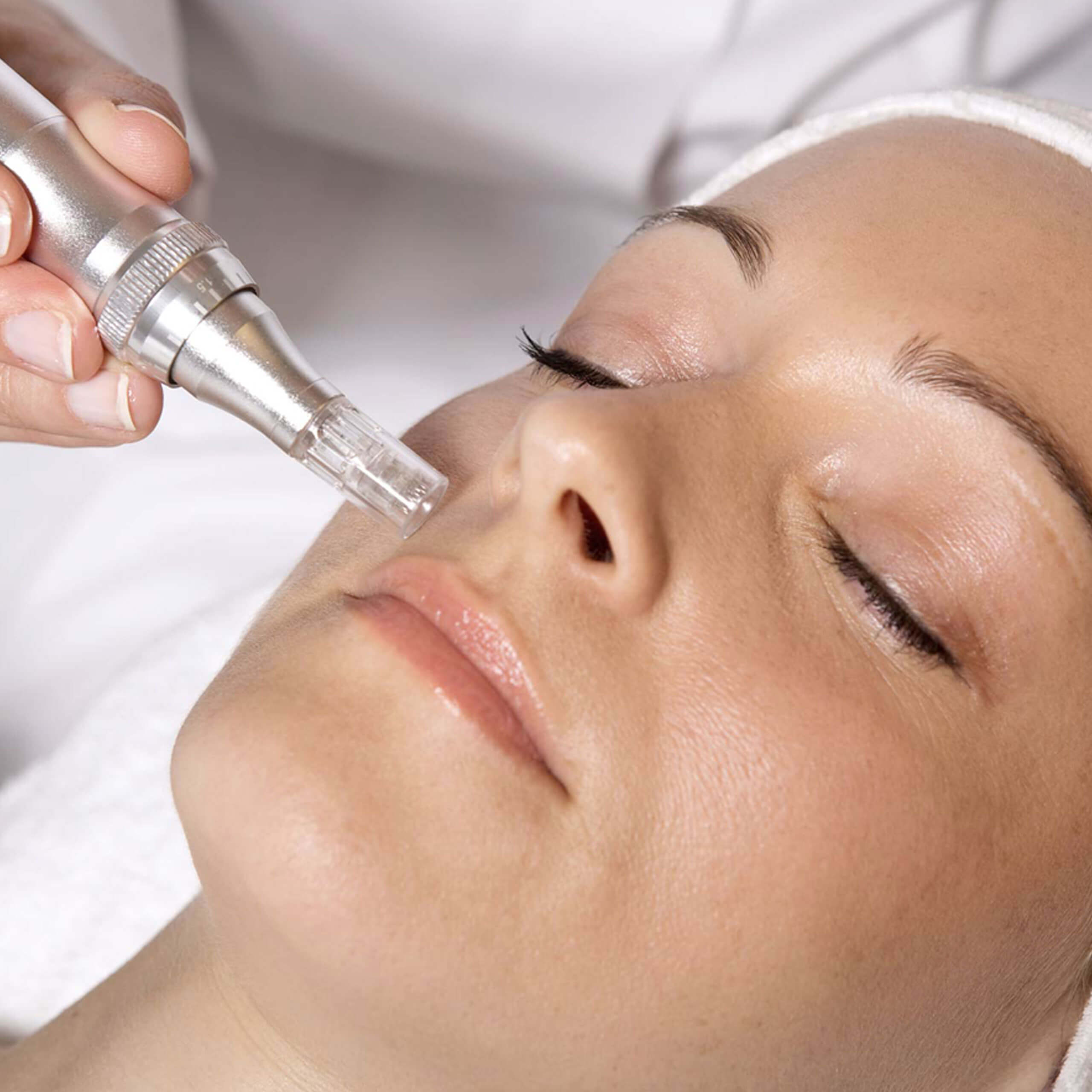 Microneedling - Dermapen