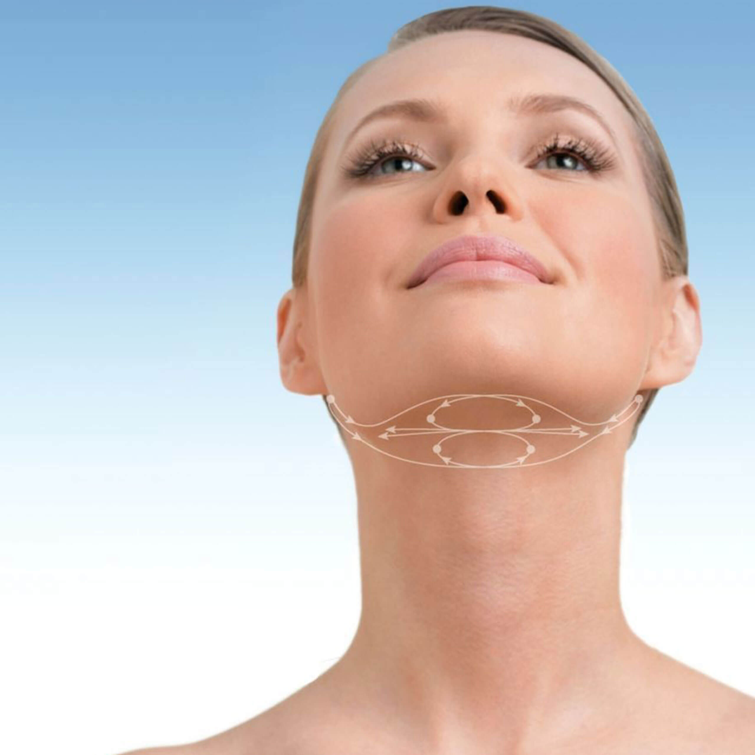 Neck Lift
