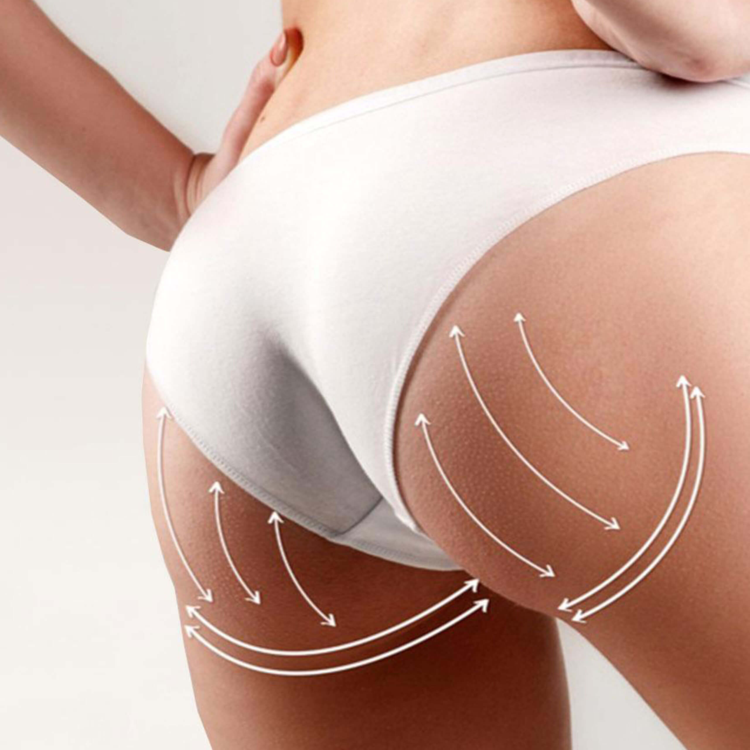 Ultrasonic - Brazilian Butt Lift (BBL)
