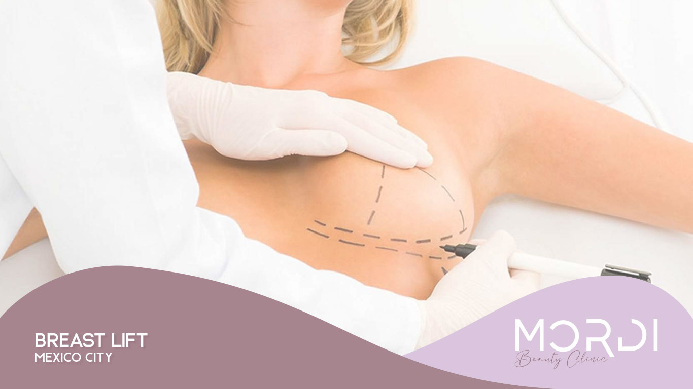 Breast Lift Mexico City