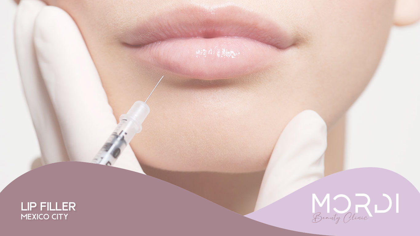 Lip Filler Mexico City