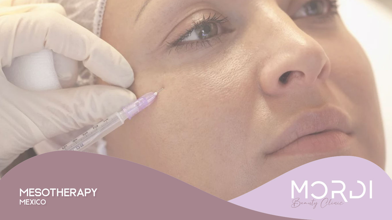 Mesotherapy Mexico