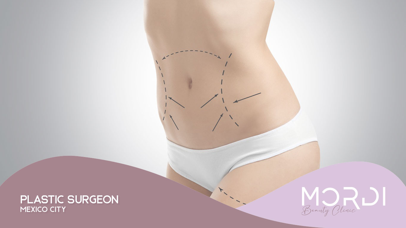 Plastic Surgeon Mexico City