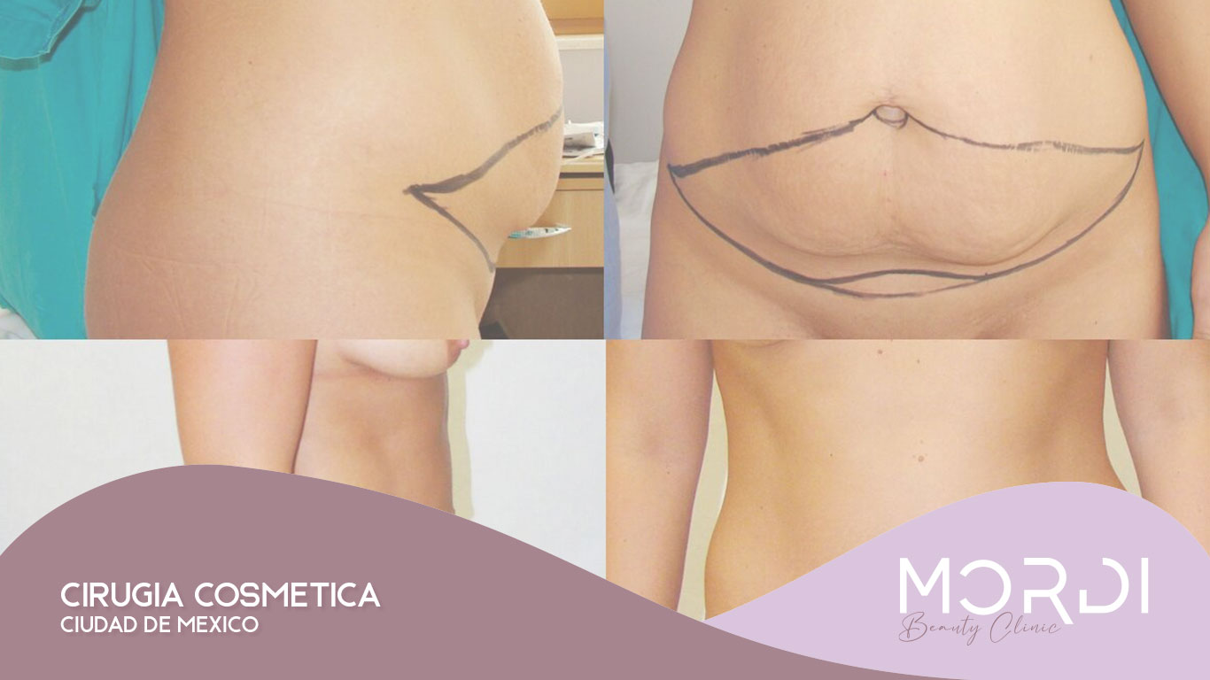 Cirugía Cosmética Ciudad de México