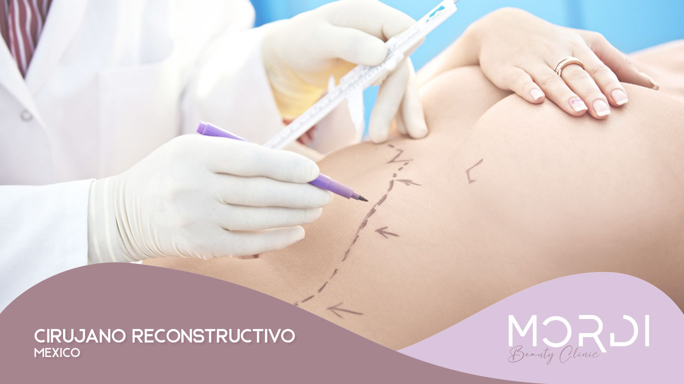 Cirujano Reconstructivo México