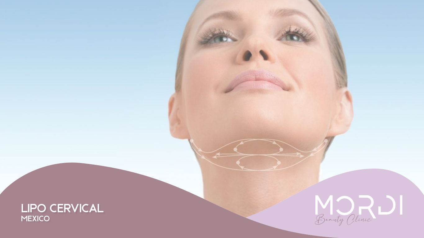 Lipo Cervical México