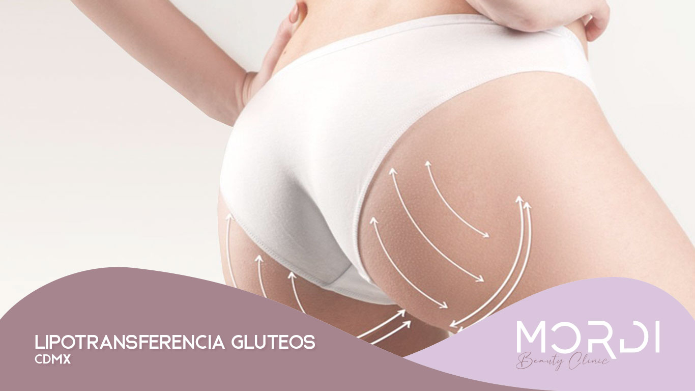 Lipotransferencia Gluteos CDMX