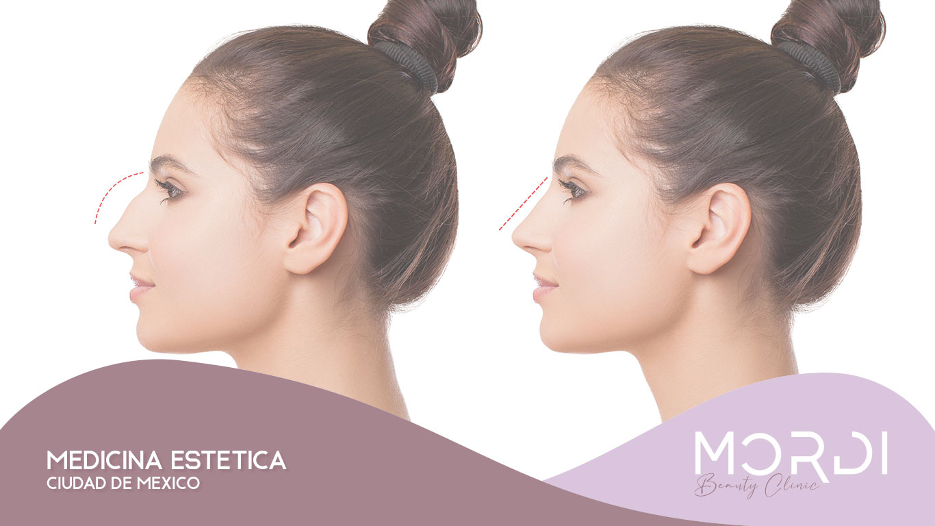 Medicina Estética Ciudad de México