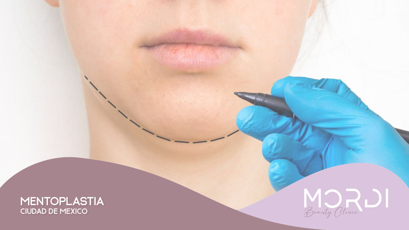 Mentoplastía Ciudad de México