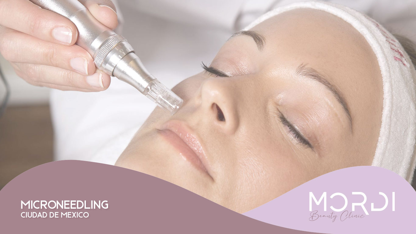 Microneedling Ciudad de México