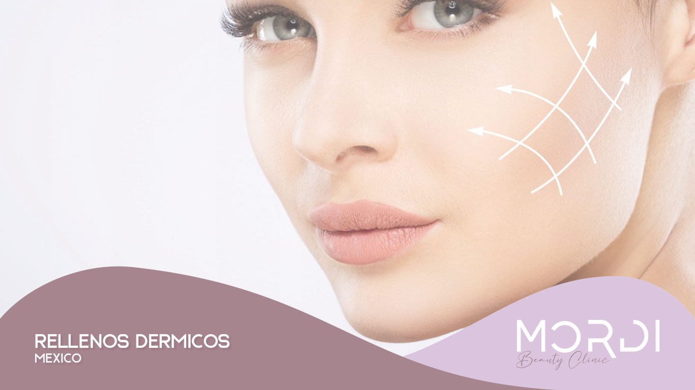 Rellenos Dérmicos México