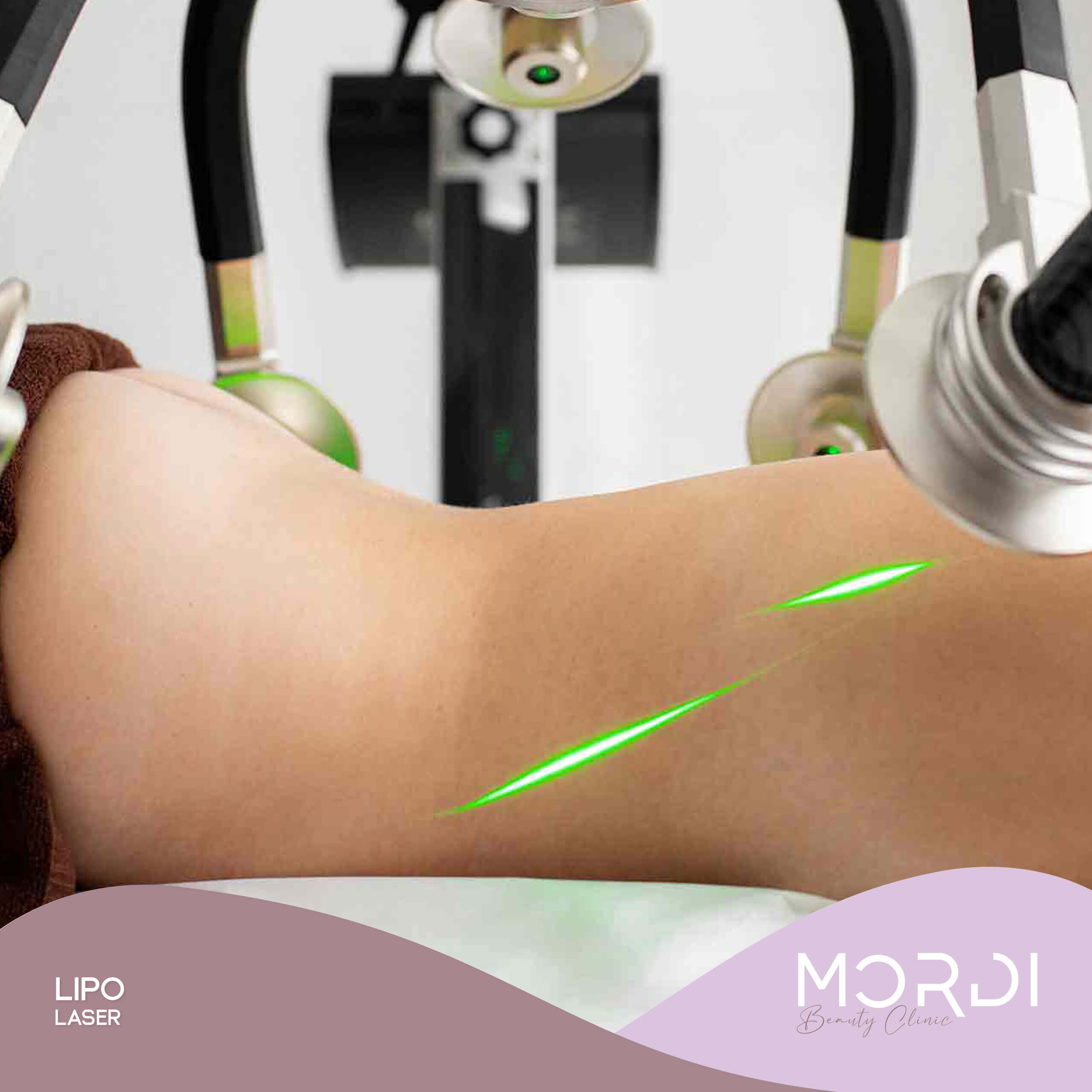 Lipo Láser Lipo Láser